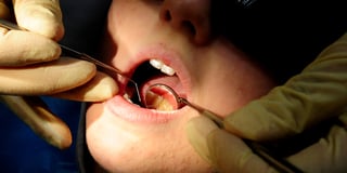 More than a dozen East Hampshire children had rotting teeth removed last year