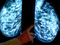 Breast screening uptake in Hampshire, Southampton and the Isle of Wight increases