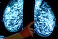 Breast screening uptake in Hampshire, Southampton and the Isle of Wight increases