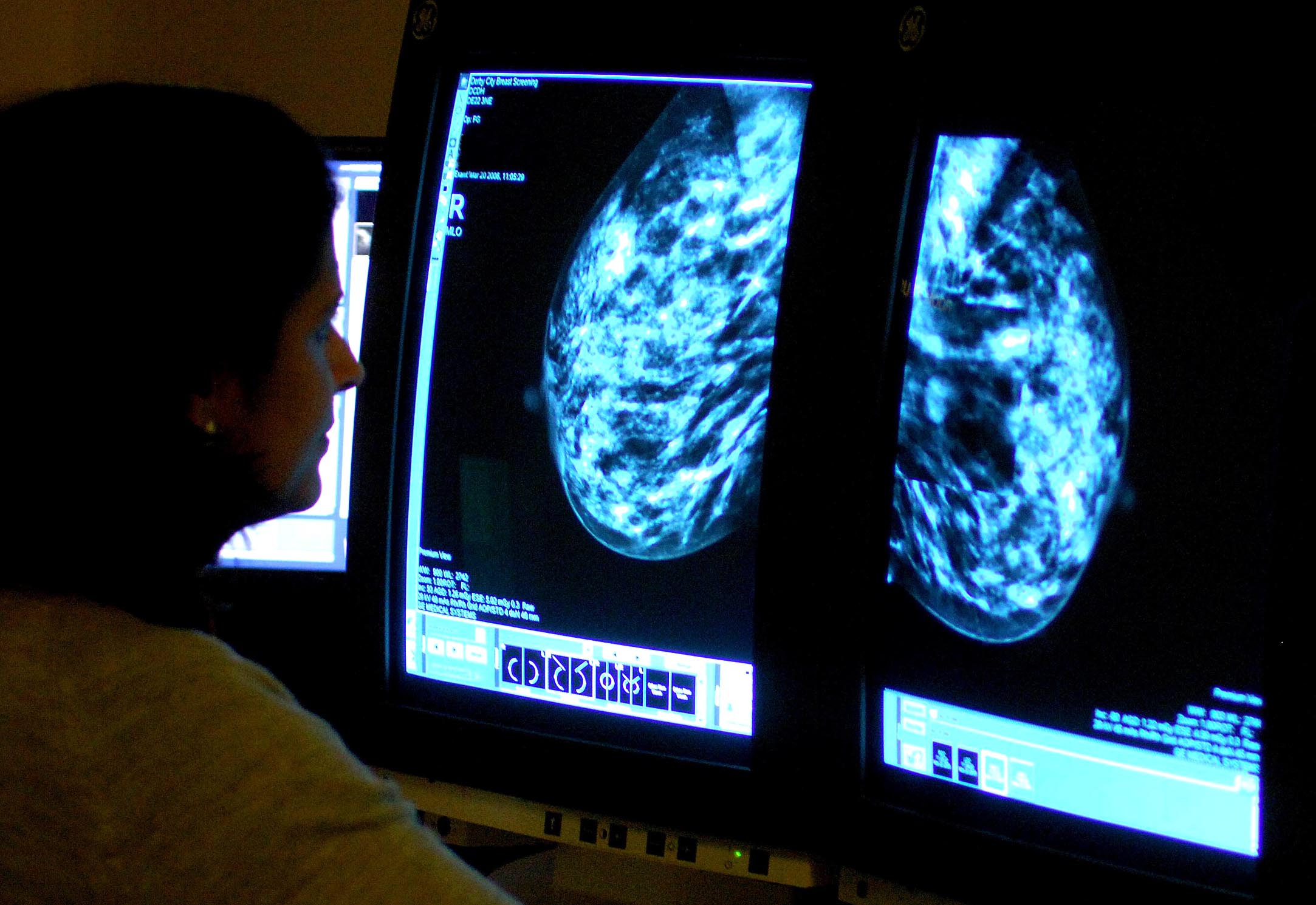 More women in Hampshire undergo breast cancer screening – as NHS England target met for first in five years