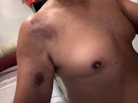Walker claims he was mauled by ‘leopard’ in Surrey Hills attack