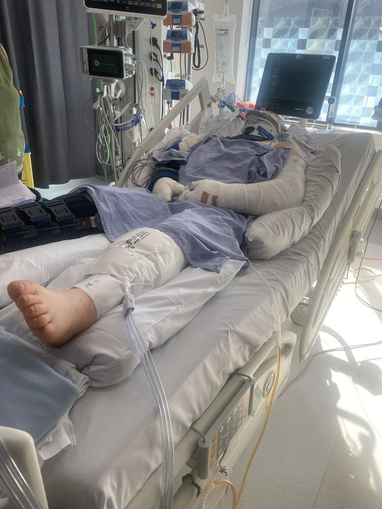 Dom in a full body case following the accident on July 4